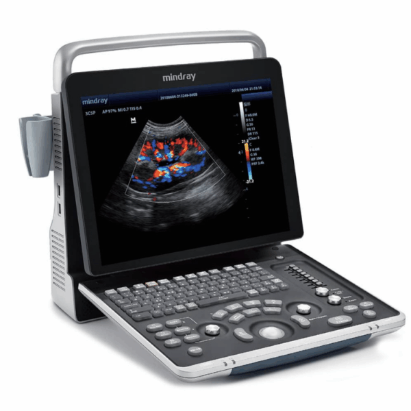 Echographe portable mindray z60