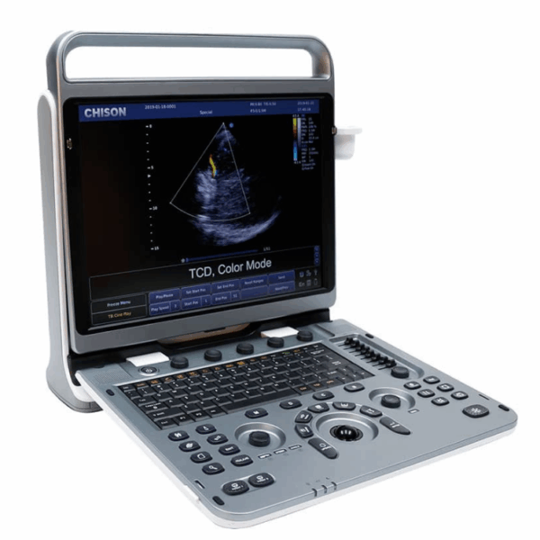 Echographe portable chison ebit50
